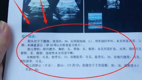 三個月b超男孩準嗎,三個月B超男孩準嗎？——關于早期胎兒性別鑒定的探討